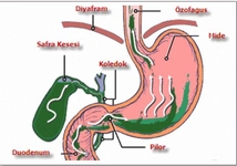 Midede Safra Belirtileri ve Tedavisi